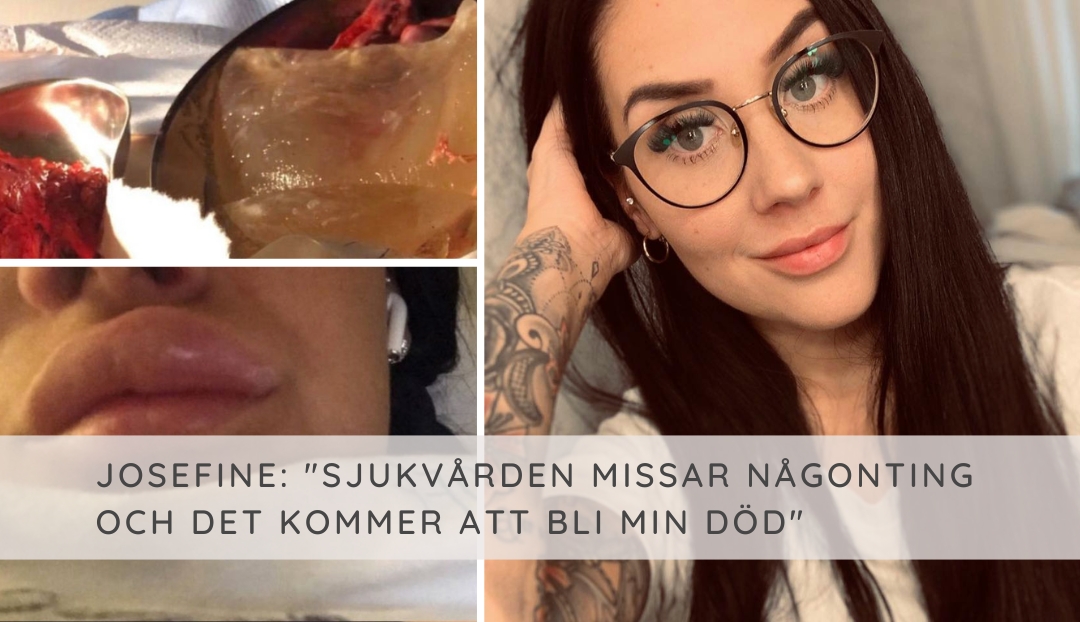 Josefines berättelse om Breast Implant Illness