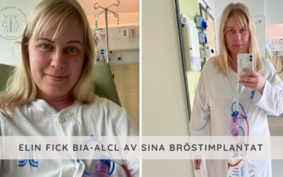 Elin berättar om när hon blev diagnostiserad med BIA-ALCL