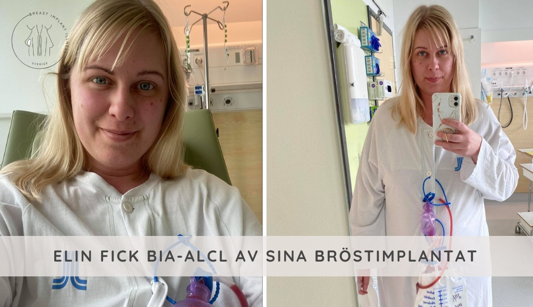 Elin berättar om när hon blev diagnostiserad med BIA-ALCL
