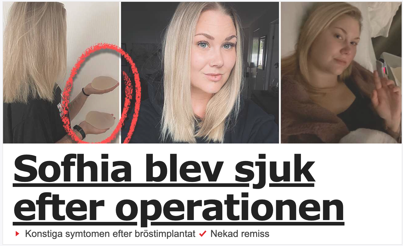 Sofhia blev sjuk av bröstimplantat