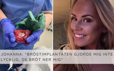 Johanna gjorde en bröstförstoring: ”Blev bara sjukare och sjukare”