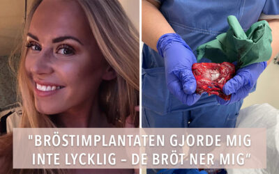 Johanna gjorde en bröstförstoring: ”Blev bara sjukare och sjukare”