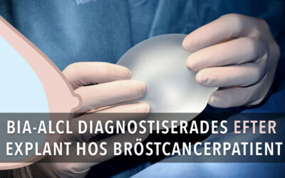 BIA-alcl upptäckt efter explant till följd av bröstcancer hos norsk kvinna – Fallrapport