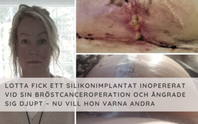 Lotta fick ett silikonimplantat vid sin bröstcanceroperation – nu vill hon varna andra för komplikationer