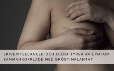 Flera typer av cancer kopplade till bröstimplantat, bia-scc & olika lymfom