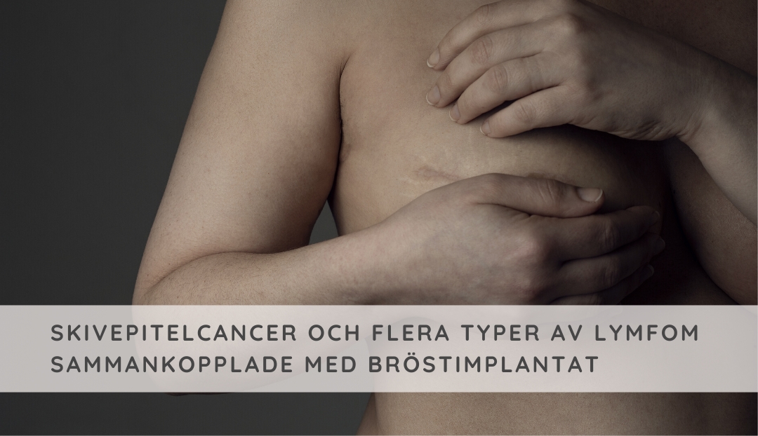 Flera typer av cancer kopplade till bröstimplantat, bia-scc & olika lymfom